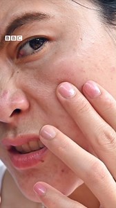 4.2K views · 22 reactions | முகப்பரு முகத்தில் இருந்து எந்த வயதில் மறையும்? Pimples எப்படி வருகிறது? Explained #Pimples #Health #SkinCare | BBC News தமிழ் | Facebook
