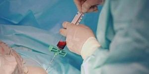 HEALTHWATCH: Platelet-rich Fibrin