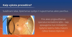 2.1K views · 21 reactions | Lazerinis tinklainės gydymas taikomas tada, kai:  prieš akis atsirado naujų drumsčių;  žybčioja ar blykčioja;  pasikeitė matymas – prieš akį užsitraukė lyg užuolaida. Jeigu jaučiate šiuos simptomus, vizitui galite registruotis telefonu: +37061595550 arba internetu: www.lirema.lt/registracija/ #Lirema #lazerinistinklainėsgydymas | Lirema akių klinika | Facebook