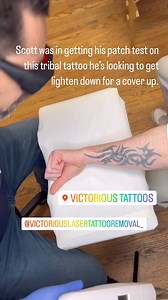 Scott was in getting his patch test to get rid of this tribal tattoo if your looking for any laser tattoo removal give us a message Victorious Laser tattoo removal. | Victorious Tattoos