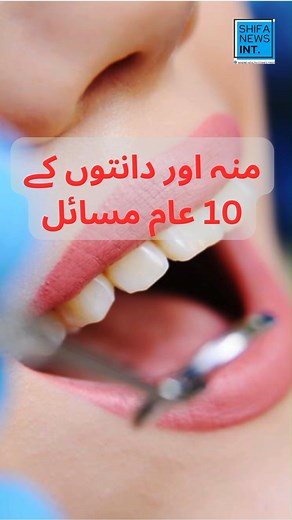 10 Common Dental Problems | Oral Health Issues | منہ کے عام مسائل #oralhealth #dentalproblems #teethproblems #badbreath #oralcancer #sensitivity #toothache #mouthulcer #bleedinggums #yellowteeth #health #wherehealthcomesfirst #sabsepehlaysehat #سب_سے_پہلے_صحت #allabouthealth #healthawareness #prevention #healthmatters #healthissues #healthylifestyle #healthybodyhealthymind #healthisablessing #urduhealthmagazine #familymagazine #shifanewsinternational #shifanews #wellness #explore #trending #vira