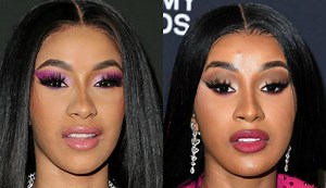 Sorcery Investigation: Did Cardi B Knife Her Nose, Eyes & Face Up?