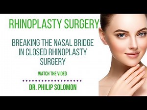 Breaking The Nasal Bridge In Closed Rhinoplasty Surgery | Dr. Philip Solomon