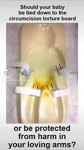 Is this a hard decision for parents? Circumcision is excruciatingly painful. It involves multiple tissue-damaging steps, including tearing, crushing, and slicing of a highly sensitive part of the body – often without adequate anesthesia – while the baby is restrained on a board. | Bloodstained Men & Their Friends