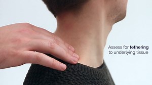 15、Neck Lump Examination - OSCE Guide UKMLA CPSA PLAB 2