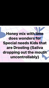 Drooling or dribbling – the unintentional loss of saliva from the mouth – can affect both children and adults with special needs. There may be a number of causes, including:Abnormalities in swallowingA reaction to medications which cause an increase in salivaDifficulty moving saliva to the back of the throatTongue thrustingJaw instabilityInflammation of the mucous membranes of the mouth. # #disability #fypシ #motivation #kids #momlife #autism #specialneedskids #specialneedsfamily #specialneedsmom