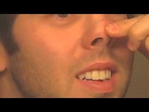 Scot's Amazing Nose Zit (It Refills)