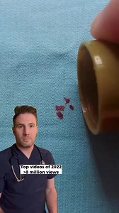 12K views · 102 reactions | Recapping my top videos of 2022. Removing blood stains. #bloodstain #stainremoval #lifehacks #laundryhack | Mary Johnson | Facebook