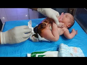 Precious First Poop(meconium) Safe Newborn Diaper Change & Warmer Care