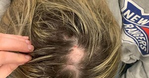 Disabled schoolgirl has hair 'ripped out' by gang of teens in horror attack