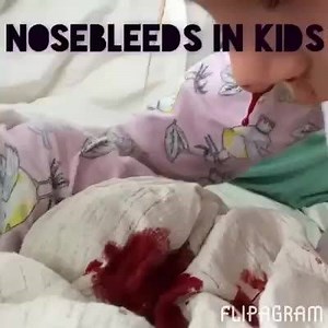 11K views · 20 reactions | Nosebleeds in kids- sit up, pinch the nostrils, lean forward, apply cold if needed, and no blowing! #cprkids #nosebleeds | CPR Kids First Aid | Facebook