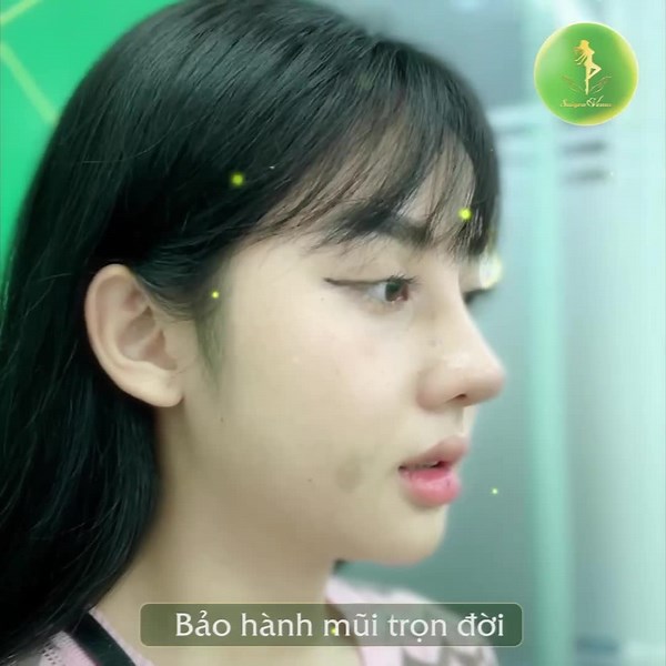 64K views | NÂNG MŨI GIẢM NGAY 40% - CHỈ TỪ 15TR Mũi đẹp chỉ sau 1...