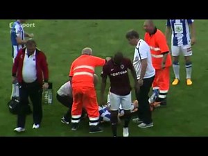 [CHOC] Double fracture tibia-péroné sur un tacle