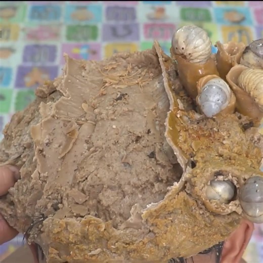 Dry Itchy Scalp Satisfying And Picking Ranking Dandruff Removal Worms In Hole #2033 #ticks #removetick #Dandruff #dandrufftreatment #dandruffremoval | Help remove ticks