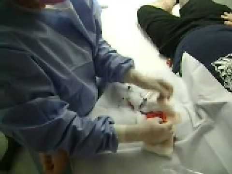 Picc Line Insertion
