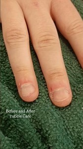 Let's Clean Up These Cuticles! 🫣💅 #nails #manicure #nailtechlife #beforeandafter #nailbiter