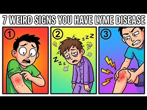 Lyme Disease: 7 Deadly Signs Your Doctor Isn't Telling You About
