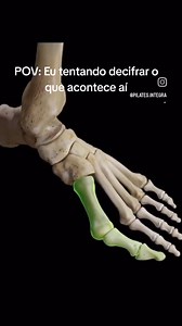 joanete, ou hálux valgo, é uma deformidade óssea que ocorre na articulação do dedão do pé, resultando em um desvio lateral do dedo. Mas como isso acontece? 🤔 Vamos entender a biomecânica por trás disso! Quando caminhamos, o peso do corpo é distribuído nos pés, e qualquer alteração nessa distribuição pode levar ao desenvolvimento da joanete. Se o arco do pé colapsa, ou se há uma pronação excessiva (pé virando para dentro), o dedão pode ser empurrado para fora, causando o desvio característico. I