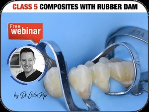 CLASS 5 COMPOSITES WITH RUBBER DAM ISOLATION