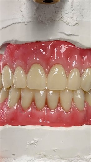 5.1K views · 11 reactions | Trying out the bite! Case from Dr. Anton Sauer in Minnesota! | CEO Luke Kahng | Facebook