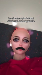 Cheveux Incrustés dans la Galoche : Un Problème Courant