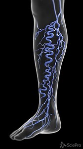 1.5K views | GIÃN TĨNH MẠCH NÔNG CHI DƯỚI Suy giãn tĩnh mạch chân...