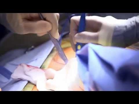 British Heart Foundation - Your guide to heart valve replacement surgery