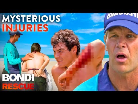 Top 5 Mysterious Injuries Lifeguards Couldn't Explain!