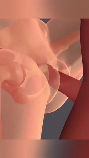 How Shockwave Therapy For Peyronies Actually Works? (3D Animation) #shockwavetherapy #peyroniesdisease #shockwavetreatment #shockwavetherapymachine #peyronie