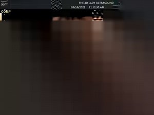 3.1K views · 114 reactions | babe needed a quick snack! #18weeks | The 4D Ultrasound Lady | Facebook