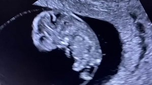 Hollyoaks star Callum Kerr announces he is going to become a dad