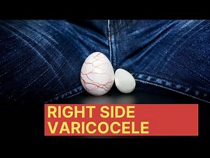 Varicocele of the Right Testicle : How to cure it without Surgery ?