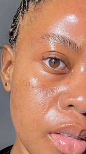 965K views · 10K reactions | From oily acne-prone to dry skin. From...