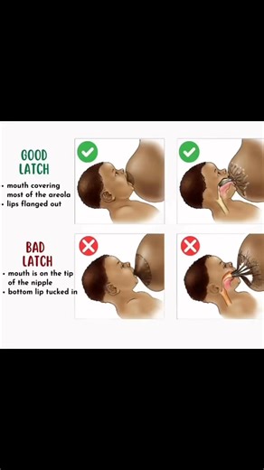 Good Latch vs Bad Latch #lactation #LactationEducation #PregnancyWellness #newbornessentials | Dimax Life Sciences