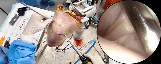 Shoulder Arthroscopy (Cadaver) | Journal of Medical Insight