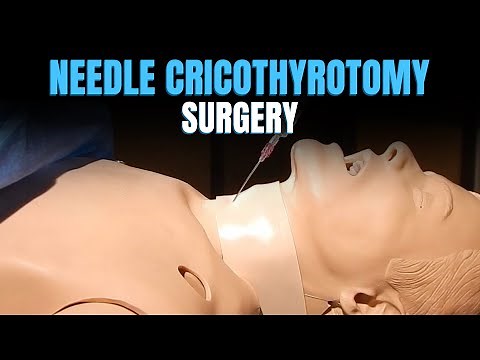 "Demystifying Needle Cricothyrotomy: An In-Depth Animated Guide by Dr. Vyshnavi"
