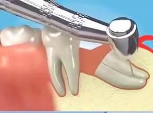 294 reactions · 113 shares | Dr Kais Laabidi on Reels | Facebook