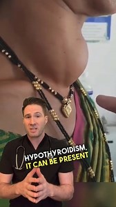 14K views · 249 reactions | Large goiter. #hypothyroidism #goiter #hyperthyroidism #neckmass #emergencymedicine | Doctor Joe | Facebook