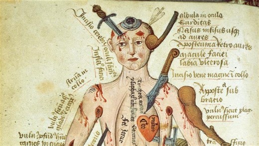 Stabbed, Slashed, And Bleeding: Meet The Medieval “Wound Man” With All The Injuries