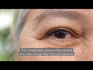 The protein ARG1 likely regulates the transformation of lens cells in fibrotic cataracts