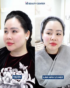 314K views · 331 reactions |  Tuổi thực 39 nhưng tuổi da mới chỉ 22...