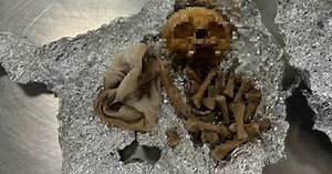 Mỹ: Khách lúng túng khi bị hỏi về bộ hài cốt người trong hành lý ở sân bay