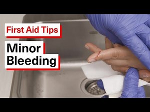 How to Help Someone with Minor Bleeding | First Aid Tips