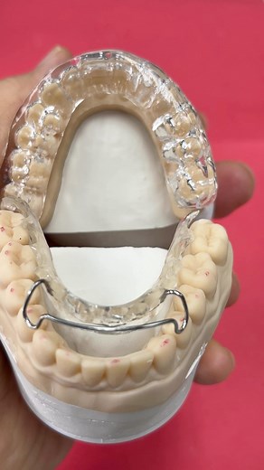 Hawley retainer vs occlu ease which is hard and soft night guard! | CEO Luke Kahng