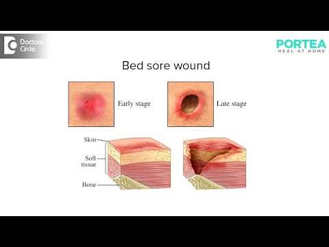 What all are the different types of wound dressing? | Portea Medical