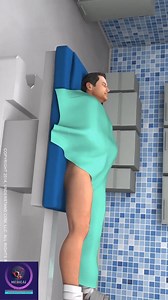 Hip Replacement Anterior Surgery in 3d animation. #hipreplacement #shorts #education #premiere #medical #animation | Medical Animation Media