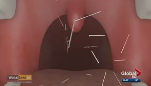 Ask an Expert: Dangers Of Asbestos