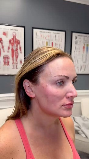 PDO Thread Lift thread 🪡 Angela Williams BSN, RN PrimeMD Aesthetics Wellness Raleigh, NC 919.948.6355 #raleighmedspa #raleighinjector #raleighbestinjector #lipaugmentationraleigh #lipinjectorraleigb #raleighlipinjector #restylaneraleigh #juvedermraleigh #lipinjectornorthcarolina #bestinjectorraleigh #faceinjectorraleigh #botoxraleigh #raleighbotox #raleighprp #prfraleigh #raleighbotoxmigraine #raleighIVhydration #raleighregenerativemedicine #raleighezgel #raleighmicroneedling | Prime MD Aesthet