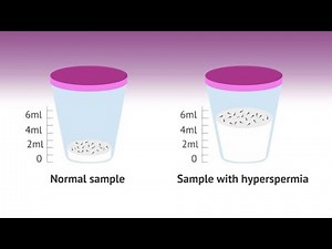 HYPERSPERMIA semen volume High #fertilitytreatment #Semen#sprum#volume#maleinfertility #male#virals