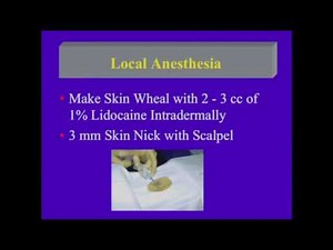 Ultrasound Guided Abdominal Biopsies Lessons Learned